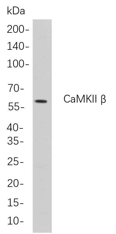 Anti-Human/Mouse/Rat CaMKII β Antibody [B835] - ABMIUM