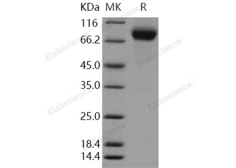 Recombinant Human LSAMP Protein (Fc Tag) - ABMIUM