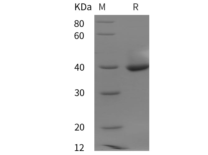 SDS-PAGE analysis of Human LDHB proteins, 2 μg/lane of Recombinant Human LDHB proteins was resolved with SDS-PAGE under reducing conditions, showing bands at 40 kDa.