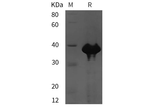 SDS-PAGE analysis of Human SIRPalpha/CD172a proteins, 2 μg/lane of Recombinant Human SIRPalpha/CD172a proteins was resolved with SDS-PAGE under reducing conditions, showing bands at 39 kDa.