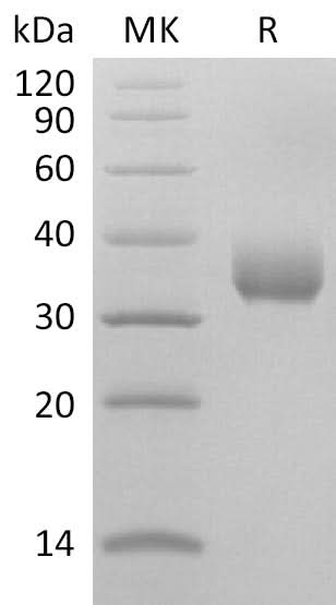 Recombinant SARS-CoV-2 Spike RBD (K458R)(His Tag) - ABMIUM