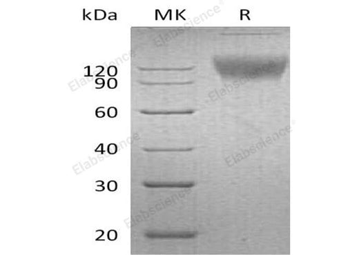 Recombinant Mouse SIRPA/CD172a Protein (Fc Tag) - ABMIUM
