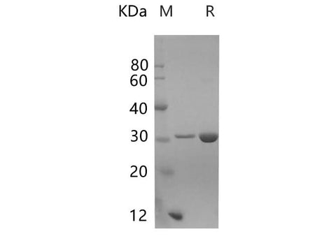 SDS-PAGE analysis of Mouse GSTM1 proteins, 2 μg/lane of Recombinant Mouse GSTM1 proteins was resolved with SDS-PAGE under reducing conditions, showing bands at 28 kDa.