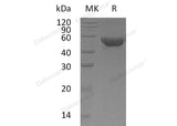 Recombinant Human MGAT2/GlcNAc-TII Protein (His Tag) - ABMIUM