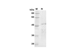 SDS-PAGE analysis of Human CEP120 proteins, 2 μg/lane of Recombinant Human CEP120 proteins was resolved with SDS-PAGE under reducing conditions, showing bands at 43 kDa.