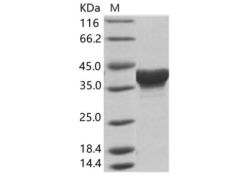 Recombinant EBOV (subtype Zaire, strain H.sapiens-wt/GIN/2014/Kissidougou-C15) Matrix protein VP40 Protein (His Tag) - ABMIUM