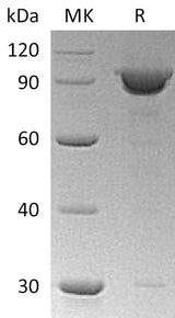 Recombinant Human KPNB1 Protein (His Tag) - ABMIUM
