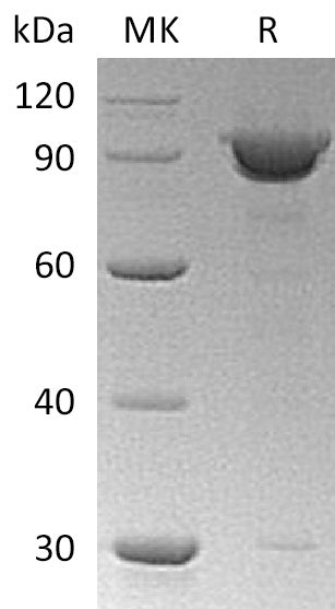 Recombinant Human KPNB1 Protein (His Tag) - ABMIUM