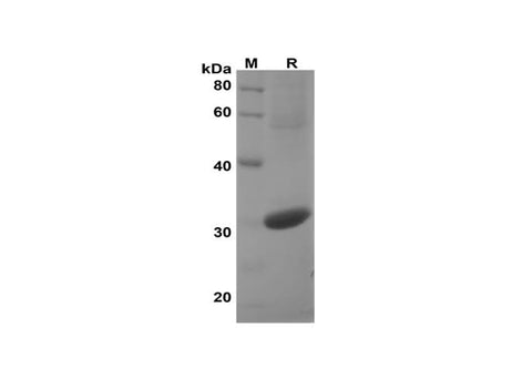 SDS-PAGE analysis of Mouse AKT1 proteins, 2 μg/lane of Recombinant Mouse AKT1 proteins was resolved with SDS-PAGE under reducing conditions, showing bands at 30 kDa.