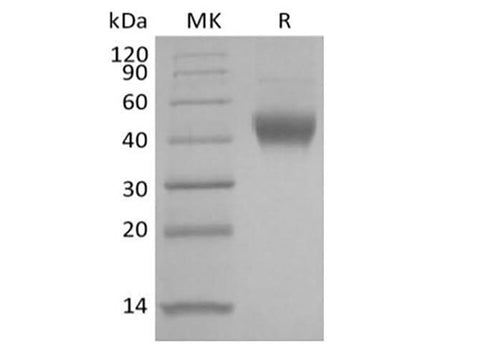 Recombinant Human IL-7 Receptor Subunit alpha/IL-7RA/CD127 (C-6His) - ABMIUM