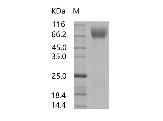 Recombinant HIV-1 (group M, subtype C, strain 92BR025) gp140 Protein (Fc Tag) - ABMIUM