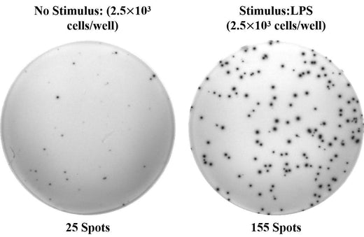 Human IL-6 (Interleukin 6) ELISPOT Kit - ABMIUM
