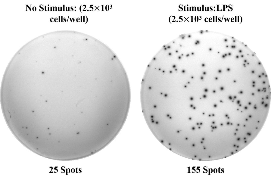 Human IL-6 (Interleukin 6) ELISPOT Kit - ABMIUM