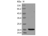 Recombinant Mouse REG3B/Pap1 Protein (His Tag) - ABMIUM