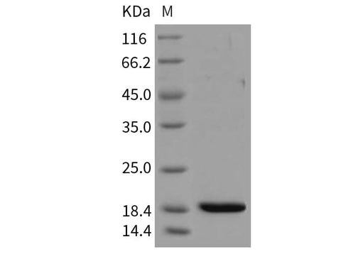 Recombinant Mouse REG3B/Pap1 Protein (His Tag) - ABMIUM