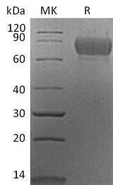 Recombinant Mouse SynCam/CADM1 Protein (aa 48-388, His Tag) - ABMIUM