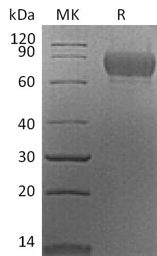 Recombinant Mouse SynCam/CADM1 Protein (aa 48-388, His Tag) - ABMIUM