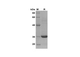 SDS-PAGE analysis of Human CCL18/PARC proteins, 2 μg/lane of Recombinant Human CCL18/PARC proteins was resolved with SDS-PAGE under reducing conditions, showing bands at 30 kDa.