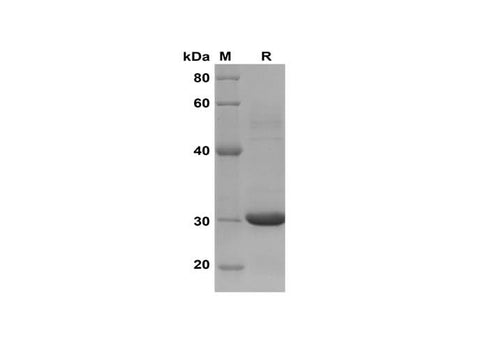 SDS-PAGE analysis of Human CCL18/PARC proteins, 2 μg/lane of Recombinant Human CCL18/PARC proteins was resolved with SDS-PAGE under reducing conditions, showing bands at 30 kDa.