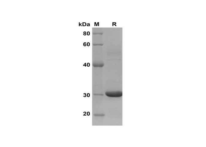 SDS-PAGE analysis of Human CCL18/PARC proteins, 2 μg/lane of Recombinant Human CCL18/PARC proteins was resolved with SDS-PAGE under reducing conditions, showing bands at 30 kDa.