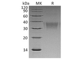 Recombinant Human Ephrin-B2/EFNB2 Protein (His Tag) - ABMIUM