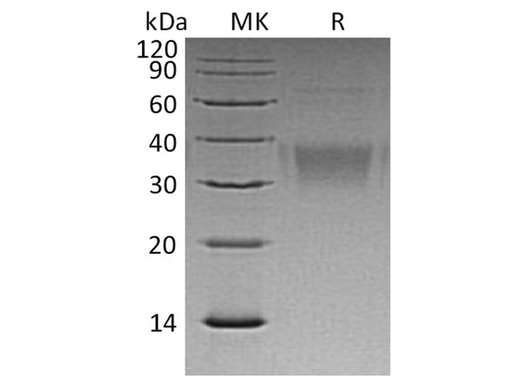 Recombinant Human Ephrin-B2/EFNB2 Protein (His Tag) - ABMIUM