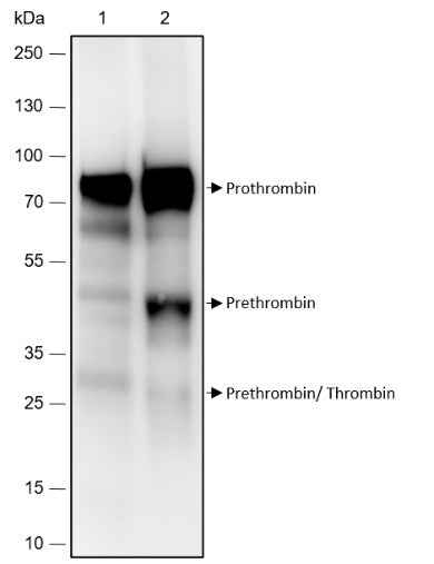 Anti-Human Prothrombin Antibody [A495] - ABMIUM