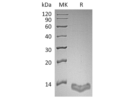 Recombinant Human S100A16/S100F Protein - ABMIUM