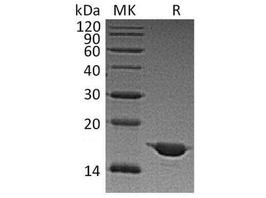 Recombinant Human Alpha-Synuclein/SNCA Protein - ABMIUM