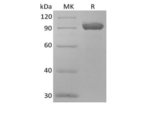 Recombinant Human NPRC/NPR3 (C-Fc) - ABMIUM