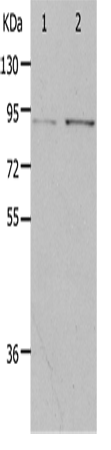 Anti-Human PIBF1 Antibody - ABMIUM