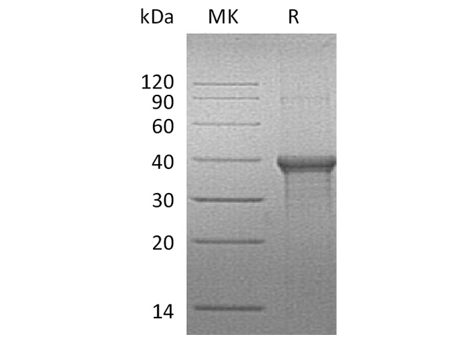 Recombinant Human BLVRA Protein (His Tag) - ABMIUM