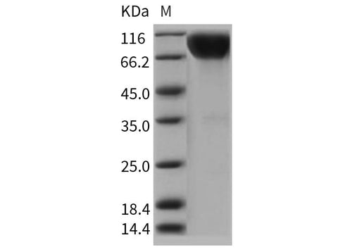 Recombinant Rat IL17RA Protein (Fc Tag) - ABMIUM