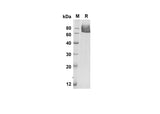 SDS-PAGE analysis of Mouse Sele Elam-1 proteins, 2 μg/lane of Recombinant Mouse Sele Elam-1 proteins was resolved with an SDS-PAGE under reducing conditions, showing bands at 58.9 kDa.