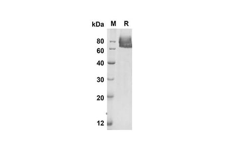 SDS-PAGE analysis of Mouse Sele Elam-1 proteins, 2 μg/lane of Recombinant Mouse Sele Elam-1 proteins was resolved with an SDS-PAGE under reducing conditions, showing bands at 58.9 kDa.