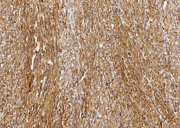Anti-Human GSTM2 Antibody [B164] - ABMIUM