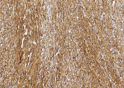 Anti-Human GSTM2 Antibody [B164] - ABMIUM