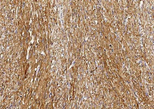Anti-Human GSTM2 Antibody [B164] - ABMIUM