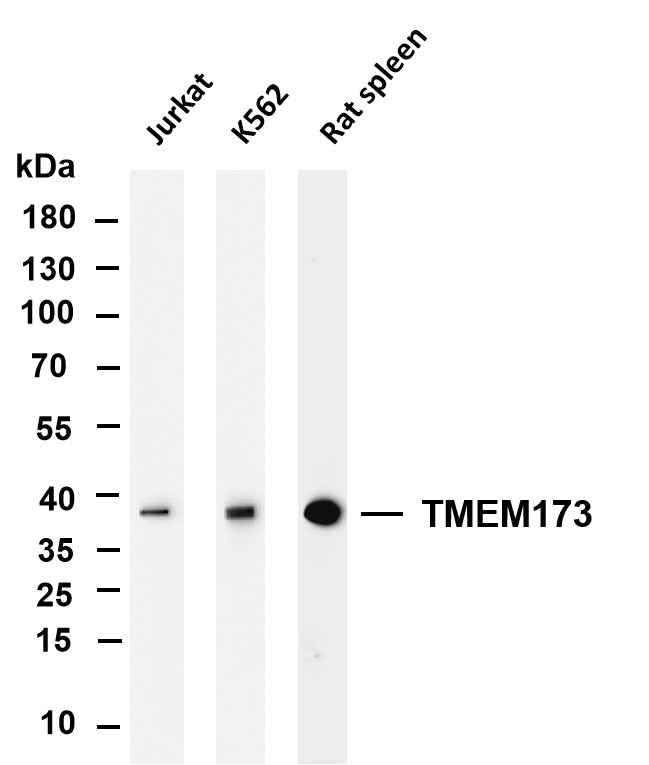 Anti-Human/Mouse/Rat TMEM173 Antibody [B839] - ABMIUM