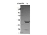 Recombinant Human YKT6 Protein (His Tag) - ABMIUM