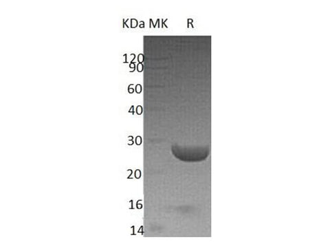 Recombinant Human YKT6 Protein (His Tag) - ABMIUM