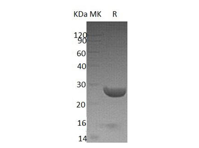 Recombinant Human YKT6 Protein (His Tag) - ABMIUM