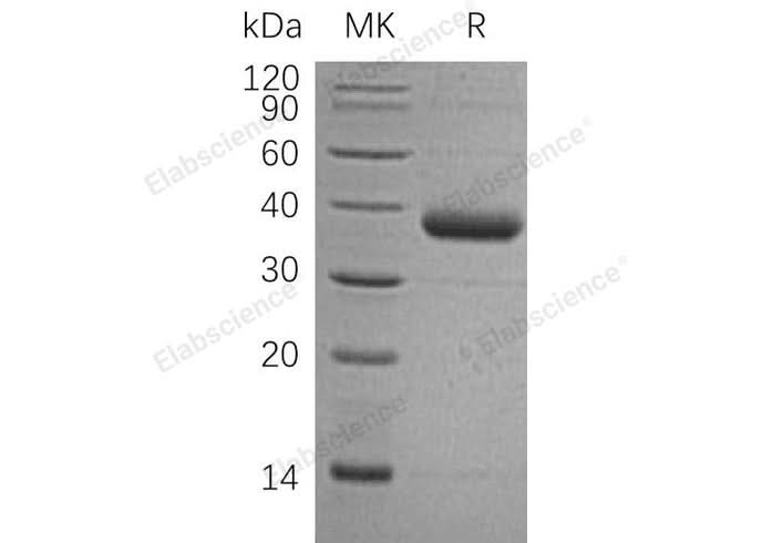 Recombinant Human C1qTNF1/CTRP1 Protein (His Tag) - ABMIUM