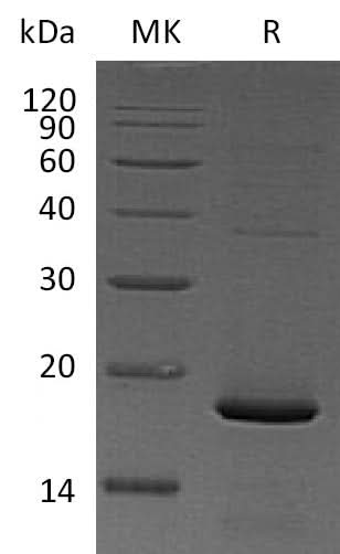 Recombinant Mouse Pleiotrophin/PTN/HB-GAM Protein (His Tag) - ABMIUM