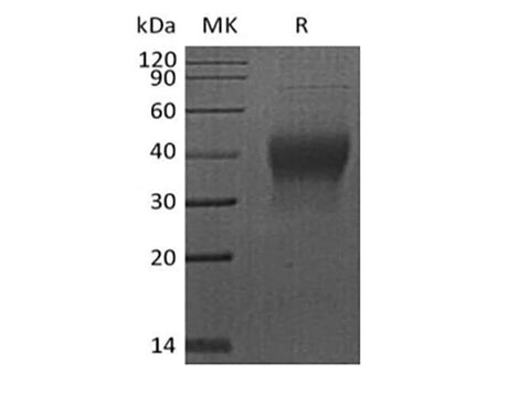Recombinant Human PDCD1/PD-1/CD279 (C-6His-Avi) Biotinylated - ABMIUM
