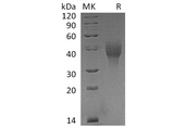 Recombinant Cynomolgus OX40/TNFRSF4 Protein (His Tag) - ABMIUM
