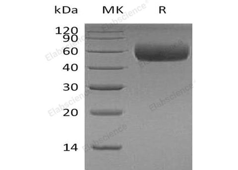 Recombinant Human Apolipoprotein H/ApoH Protein (His Tag) - ABMIUM