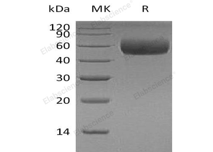 Recombinant Human Apolipoprotein H/ApoH Protein (His Tag) - ABMIUM