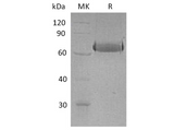 Recombinant Human EphA2 Protein (His Tag) - ABMIUM