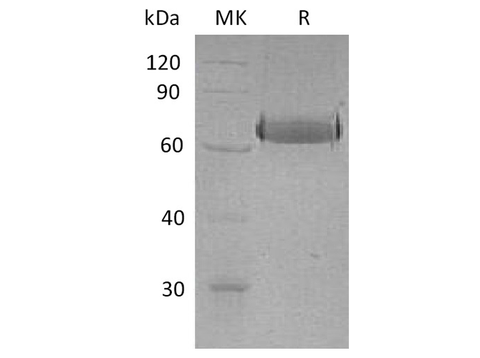 Recombinant Human EphA2 Protein (His Tag) - ABMIUM